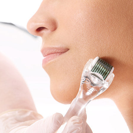 Best Skincare Products After RF Microneedling and Laser Treatments